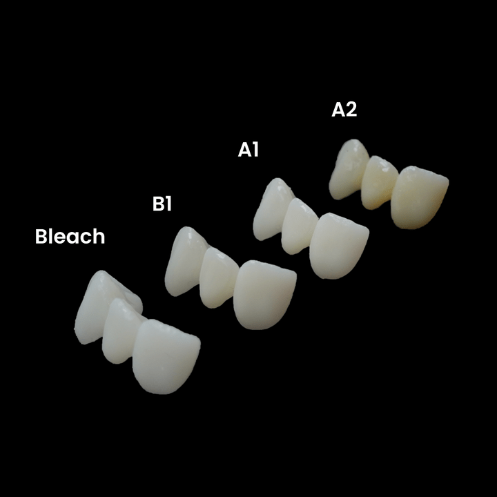 Alias - 3D Printer Resin for Dental Temp C&B - 1000 gr