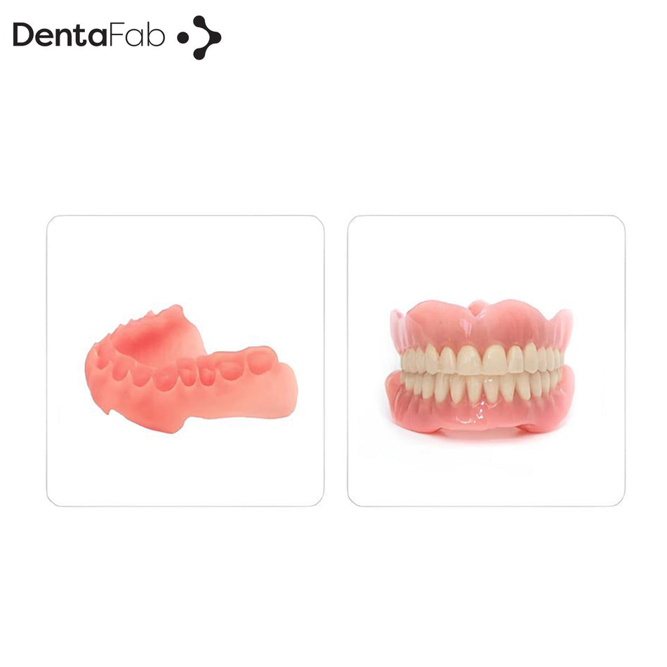 3D Printer Resin - Denture Resin - 1000 gr