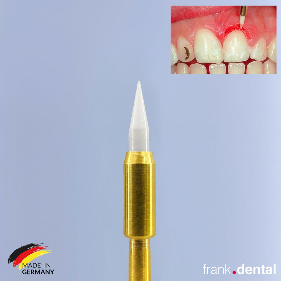 Soft Tissue Gingiva Trimmer Burs - Ceramic Gingiva Bur - GT48L - STT249