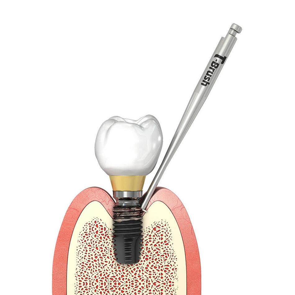 T-Brush Peri-Implantitis Brush