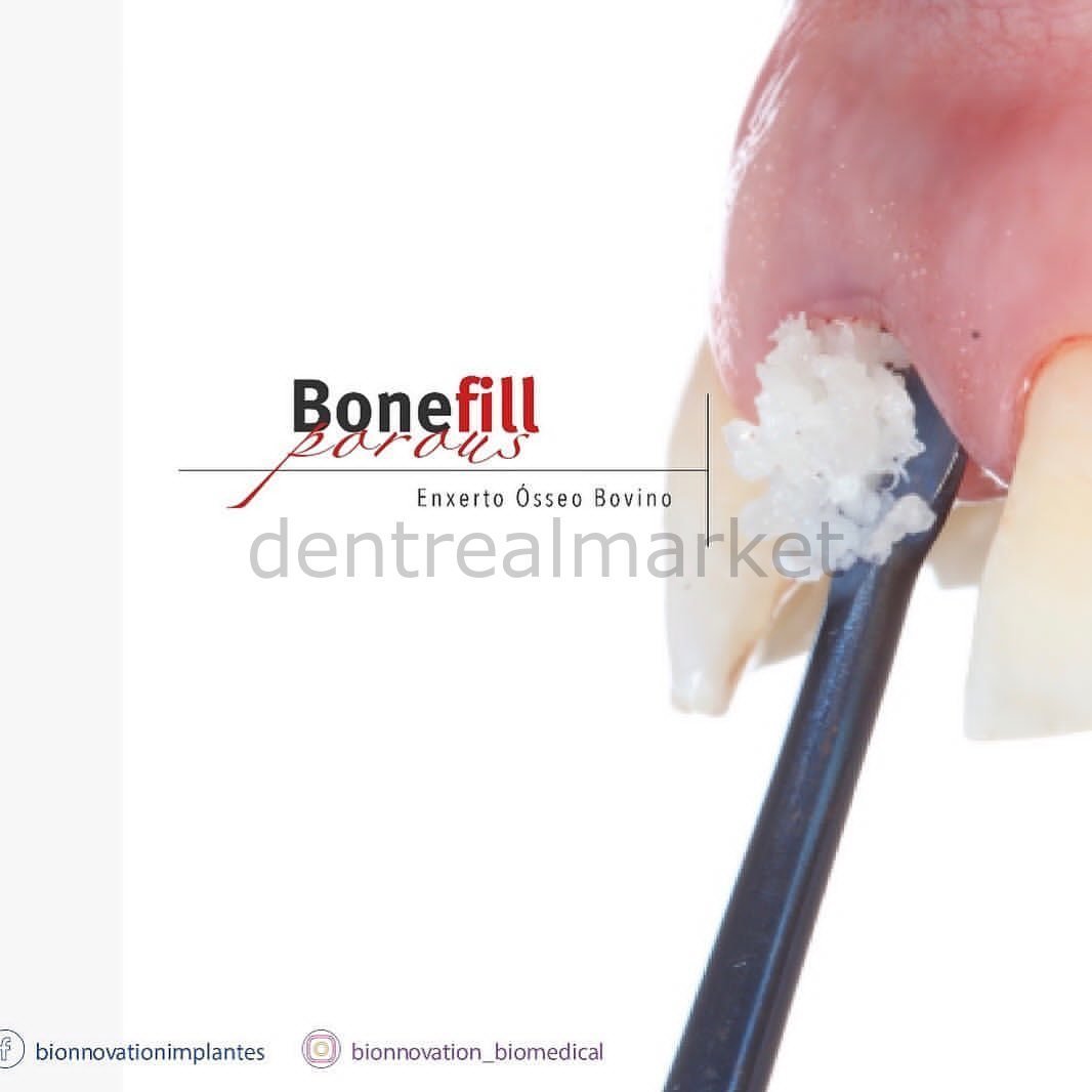 Bionnovation - Bonefill Prous (Cancellous) Bovine Graft - Xenograft - 2,5 gr (5cc)