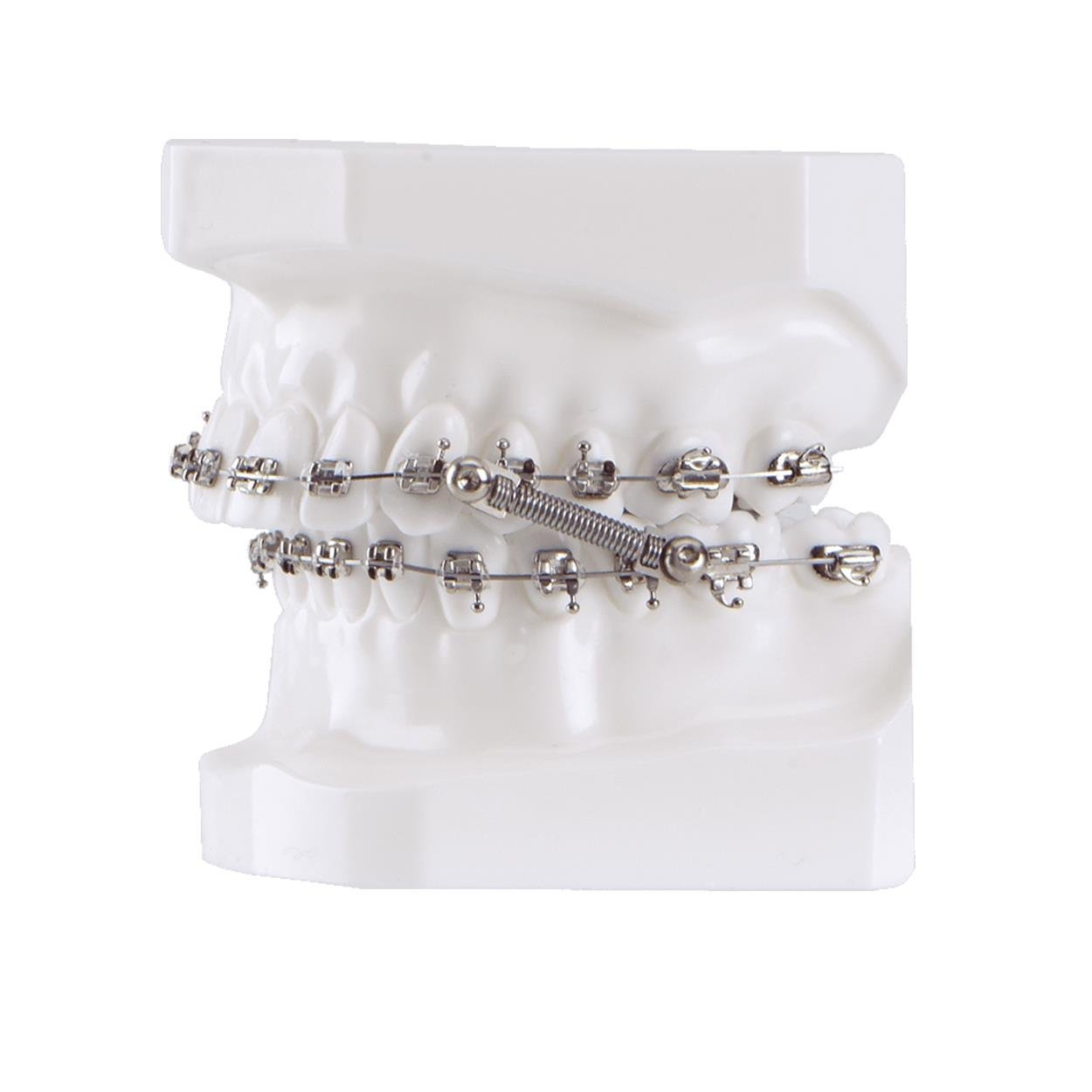 Dynaflex - Class II & Class III Corrector - CS5 5 - Patient Kit Self Ligating Pivot