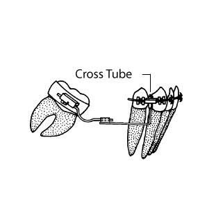 Dynaflex - Cross Tubes Tube - 1 Pcs