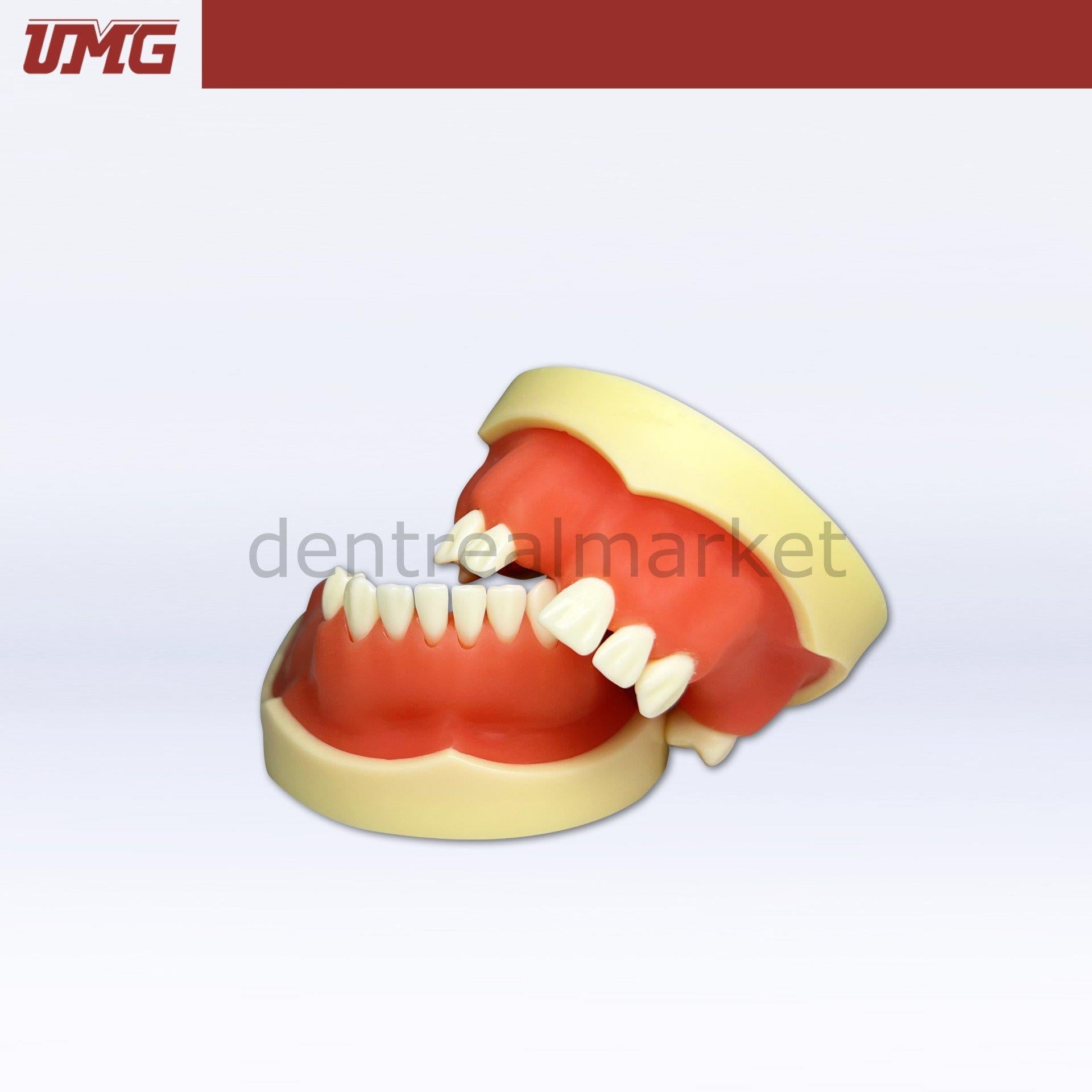 Umg Dental - Umg Model Implant Application Training Model - UM - Z2026