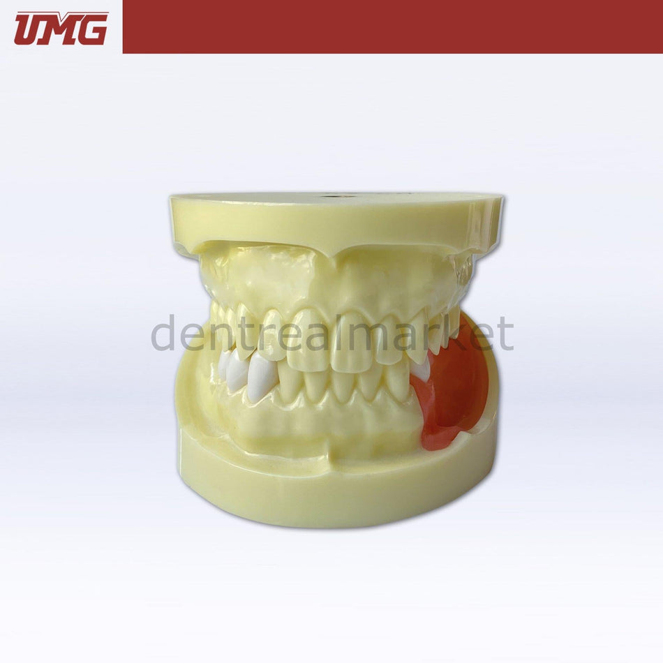 Umg Dental - Umg Model Implant Training Model Upper - Lower Jaw - UM - Z4