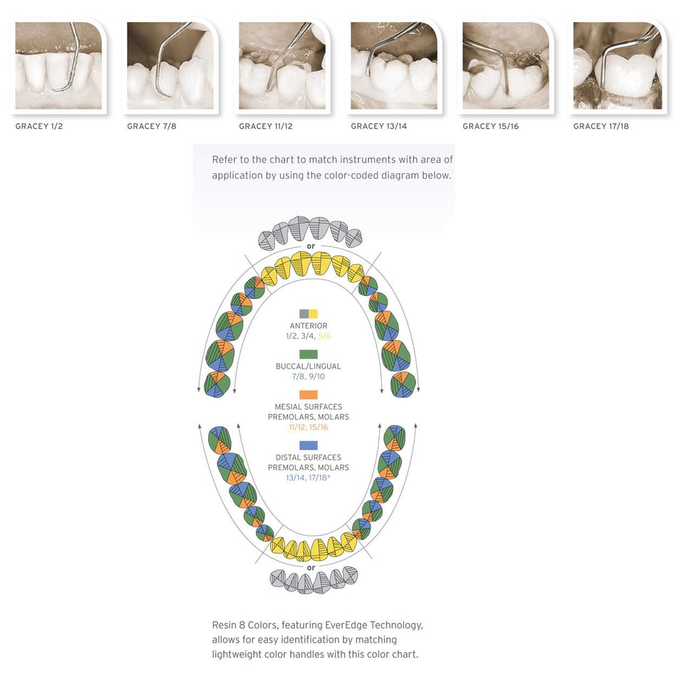 Gracey Curette Set - Periodontal Curette Set