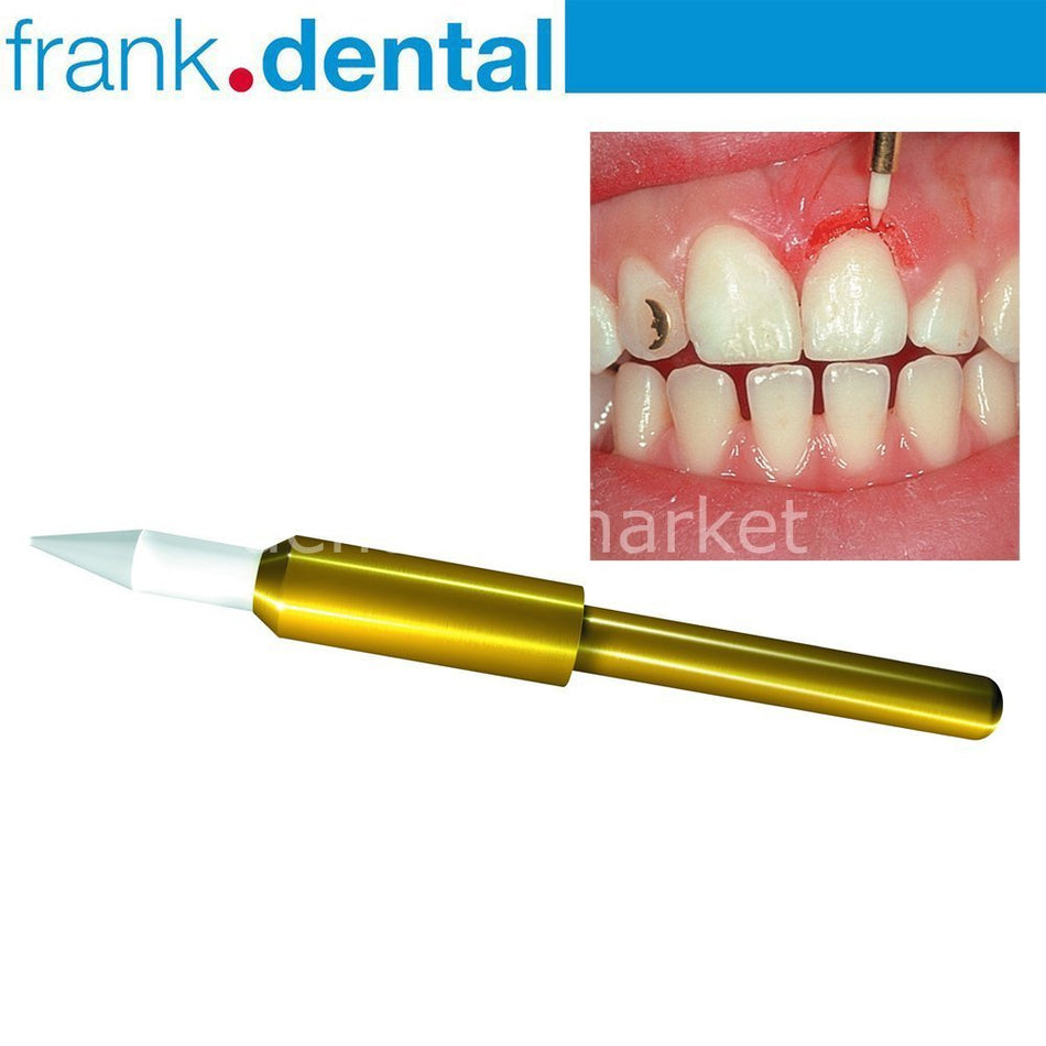 Soft Tissue Gingiva Trimmer Burs - Ceramic Gingiva Bur - GT48L - STT249